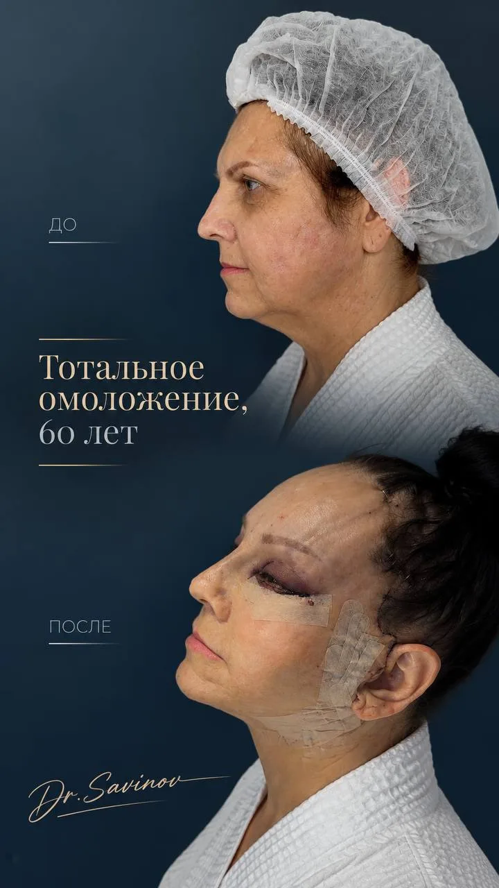Тотальное омоложение 😍