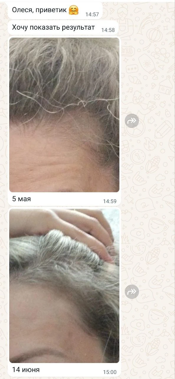 Отзыв клиента😍 результат от использования розового куба