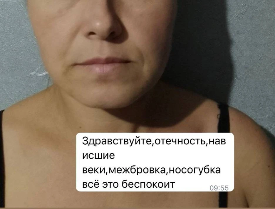 Базовая тренировка для лица: укладываем язык, чтобы убрать носогубку, брыли, дряблость ...