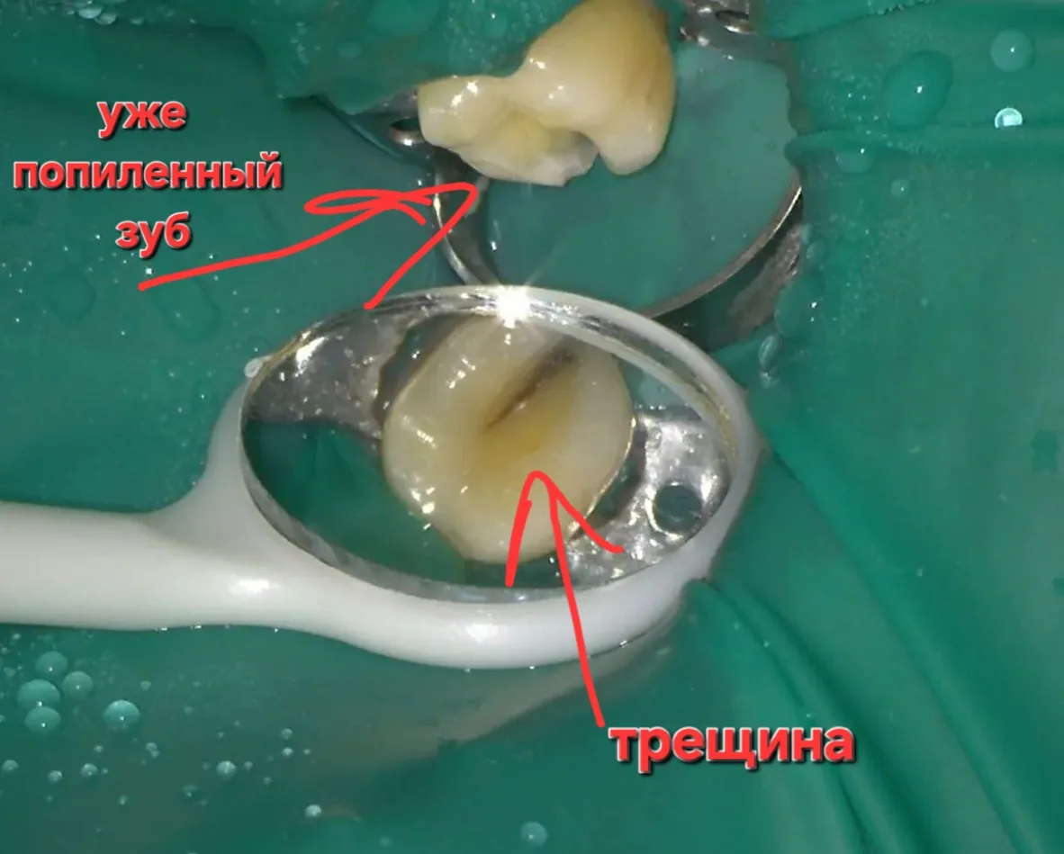 Практический кейс