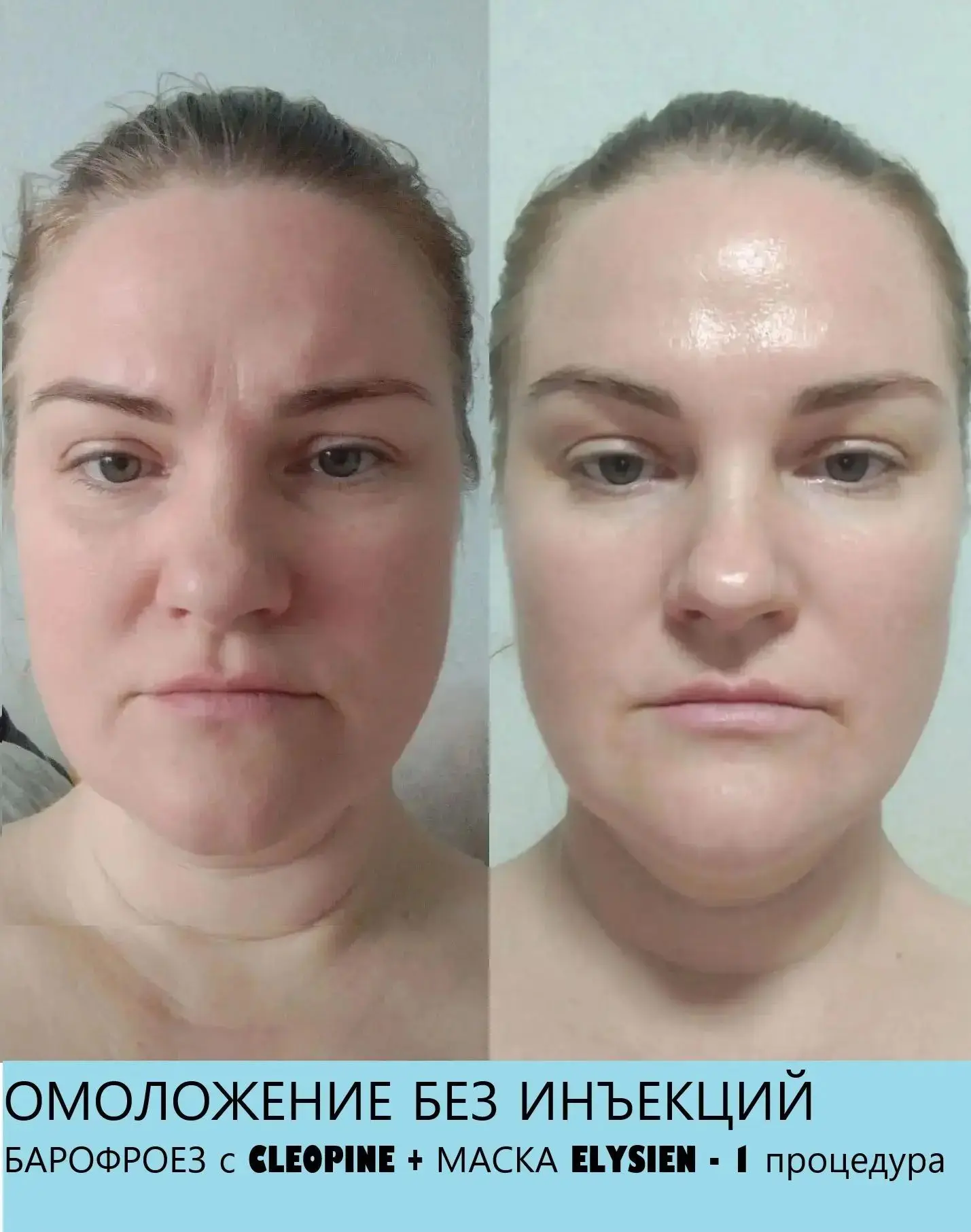 КОРОЛЕВСКИЙ УХОД ПРОТОКОЛ
