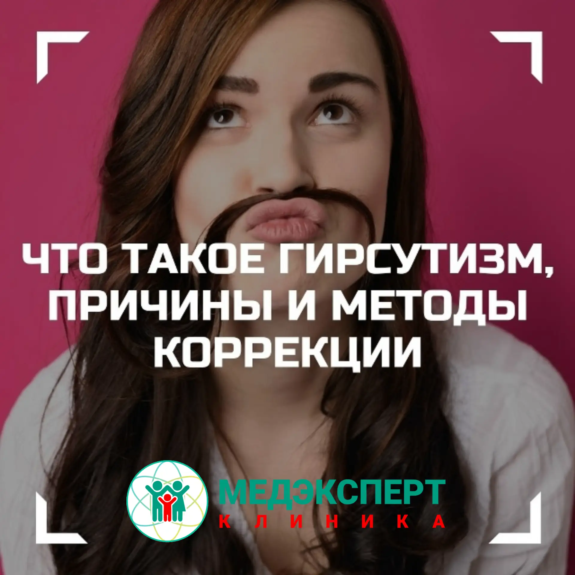Гирсутизм – избыточный рост волос на теле и лице у женщин по мужскому (андрогенному) ти...