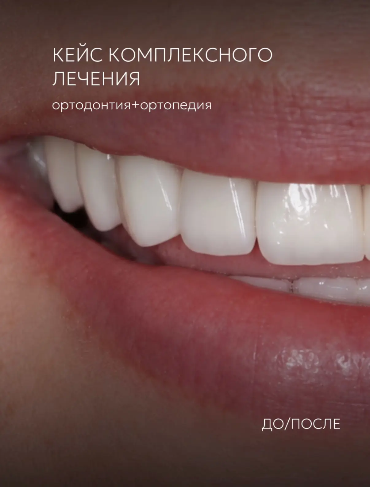 Мечта о красивой и гармоничной улыбке может стать реальностью, когда над её созданием р...