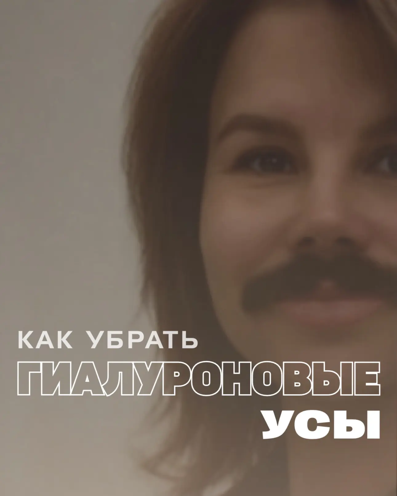 Избавиться от гиалуроновых усов, не теряя объема губ, реально!
