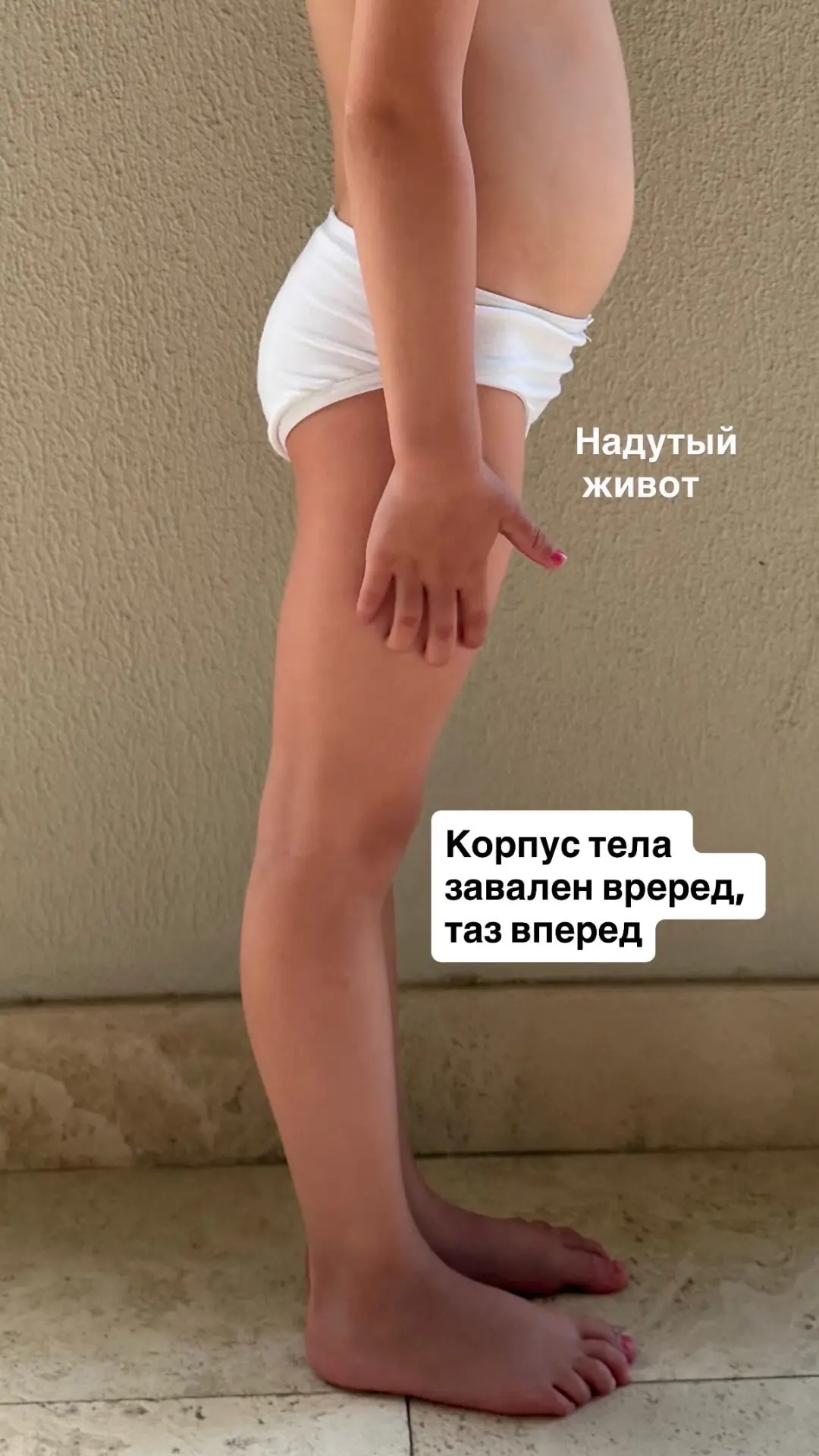 Предлагаю сегодня разобрать подробнее, как неправильная обувь негативно влияет на детск...