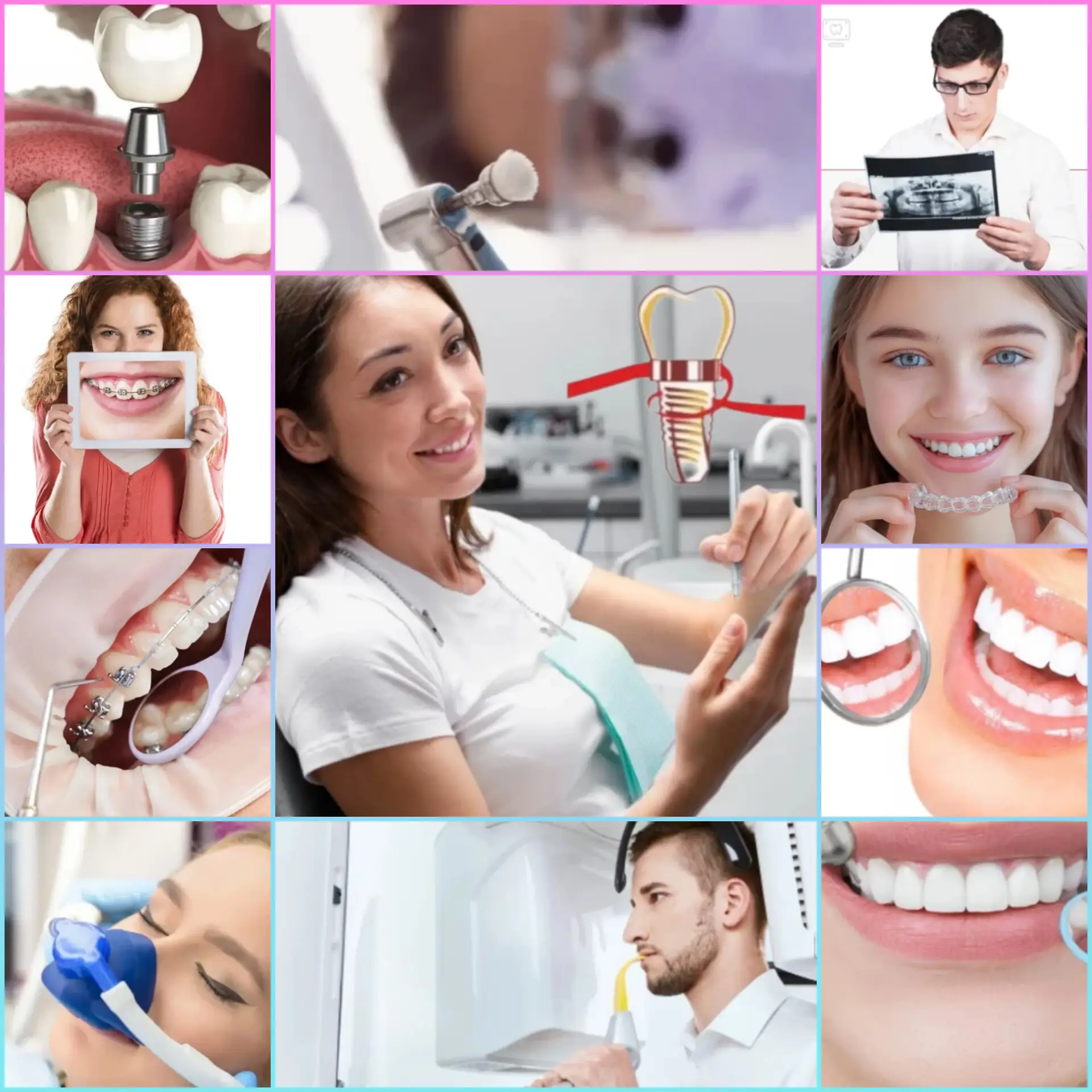 🦷 Лечение зубов, протезирование, имплантация, чистка зубов...