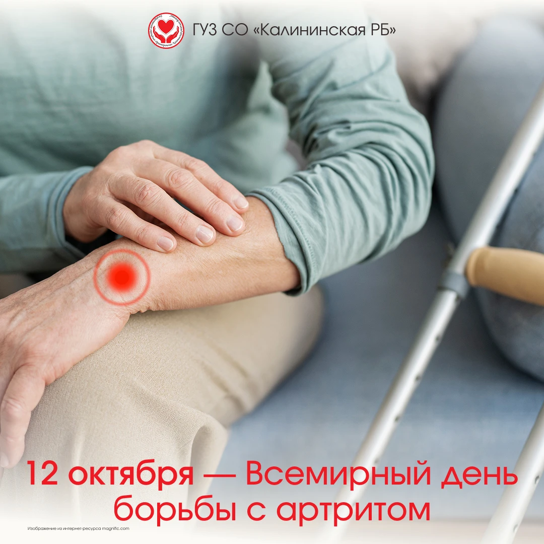 Всемирный день борьбы с артритом отмечается ежегодно 12 октября.