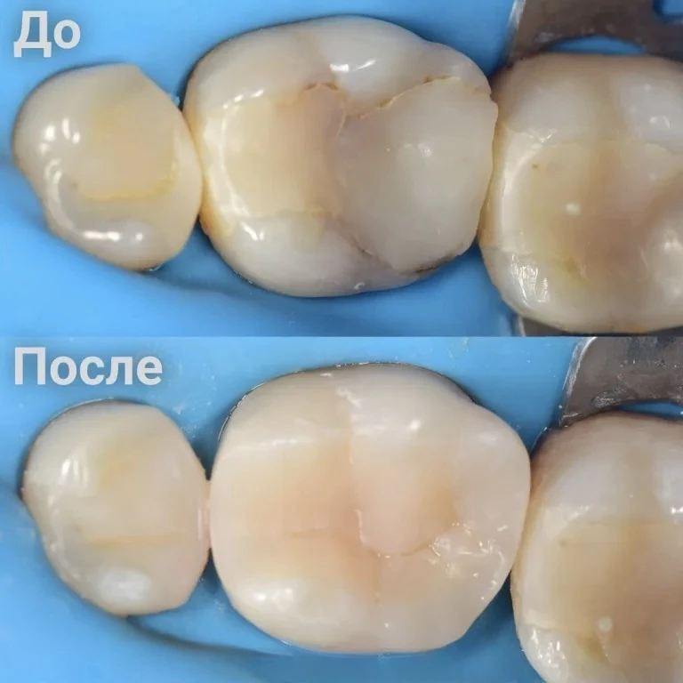 Клинический случай 🦷