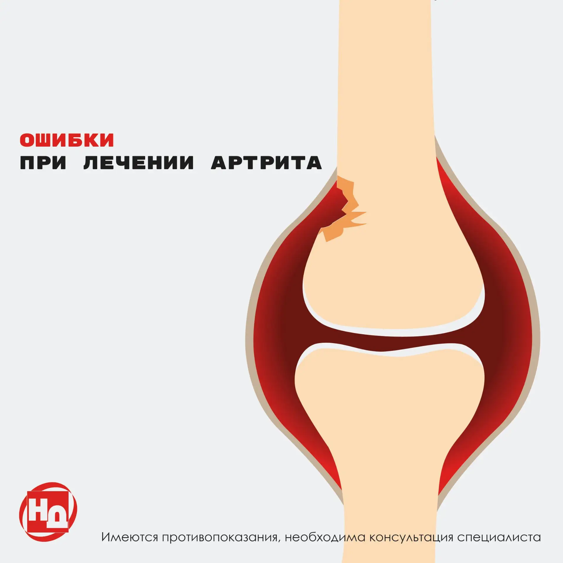 🔥 Топ‑5 ошибок при лечении артрита