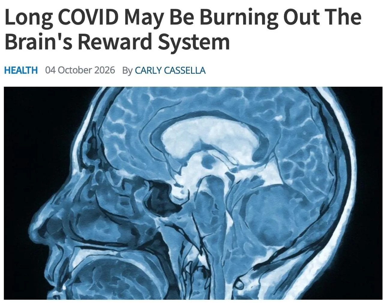 Ковид убил радость в людях: учёные обнаружили новое долгосрочное последствие — вирус вы...