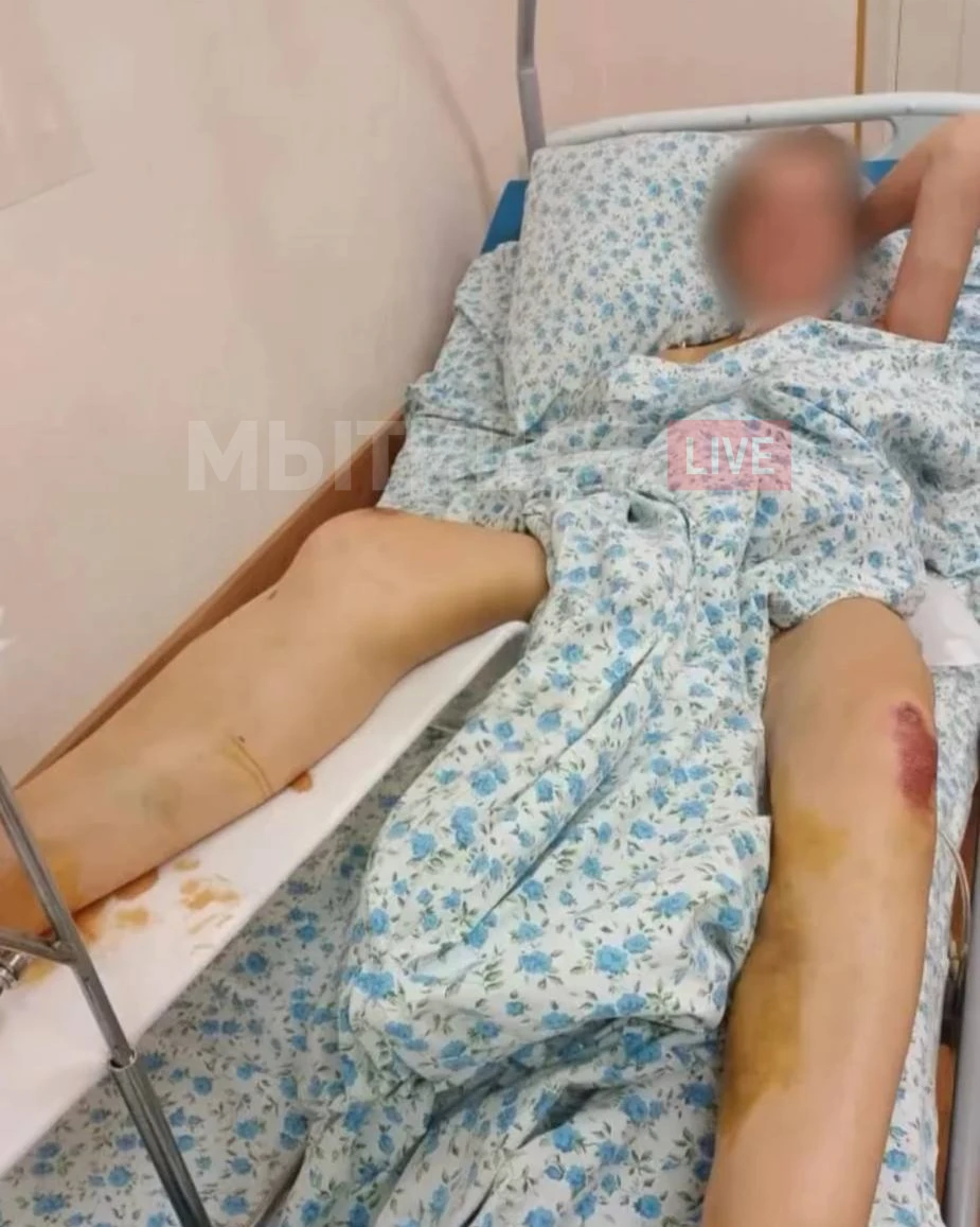 ‼️  ГОД ПОСЛЕ ДТП НА ЮБИЛЕЙНОЙ. СЕМЬЯ ПОСТРАДАВШЕЙ ГОД ПЫТАЕТСЯ ДОБИТЬСЯ ВОЗБУЖДЕНИЯ УГ...