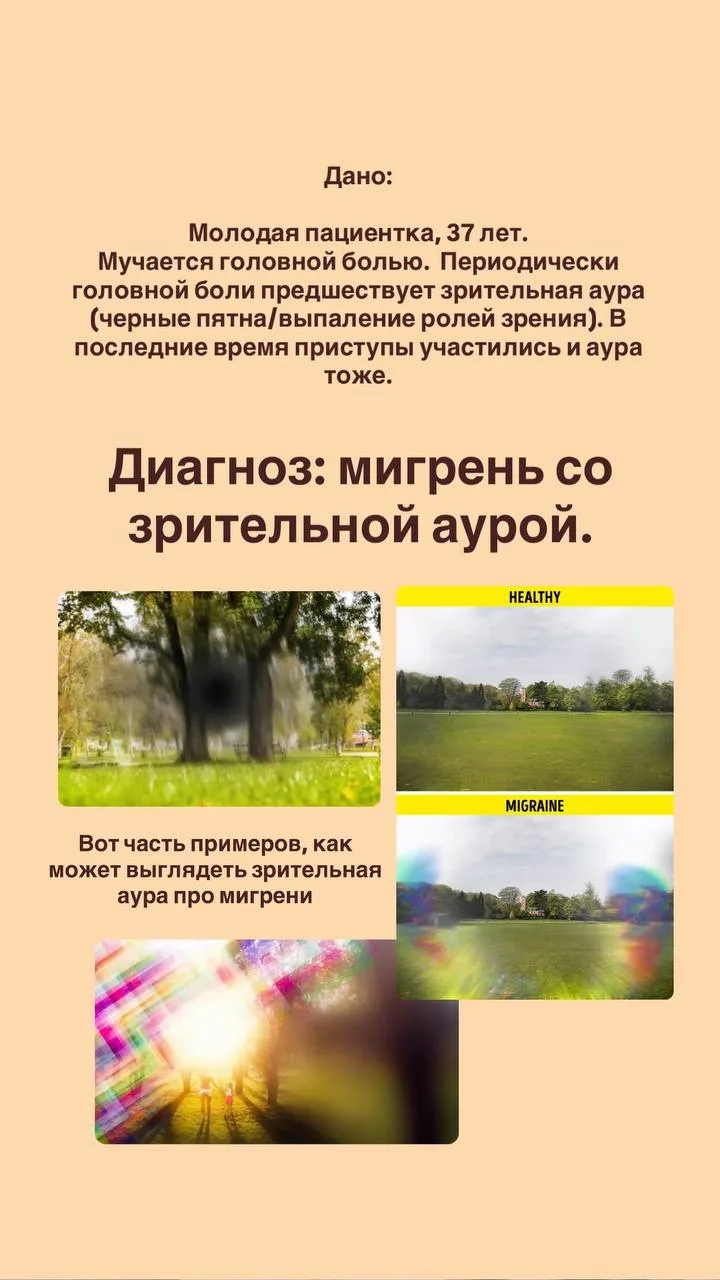 СЛУЧАЙ ИЗ ПРАКТИКИ. Мигрень и инсульт