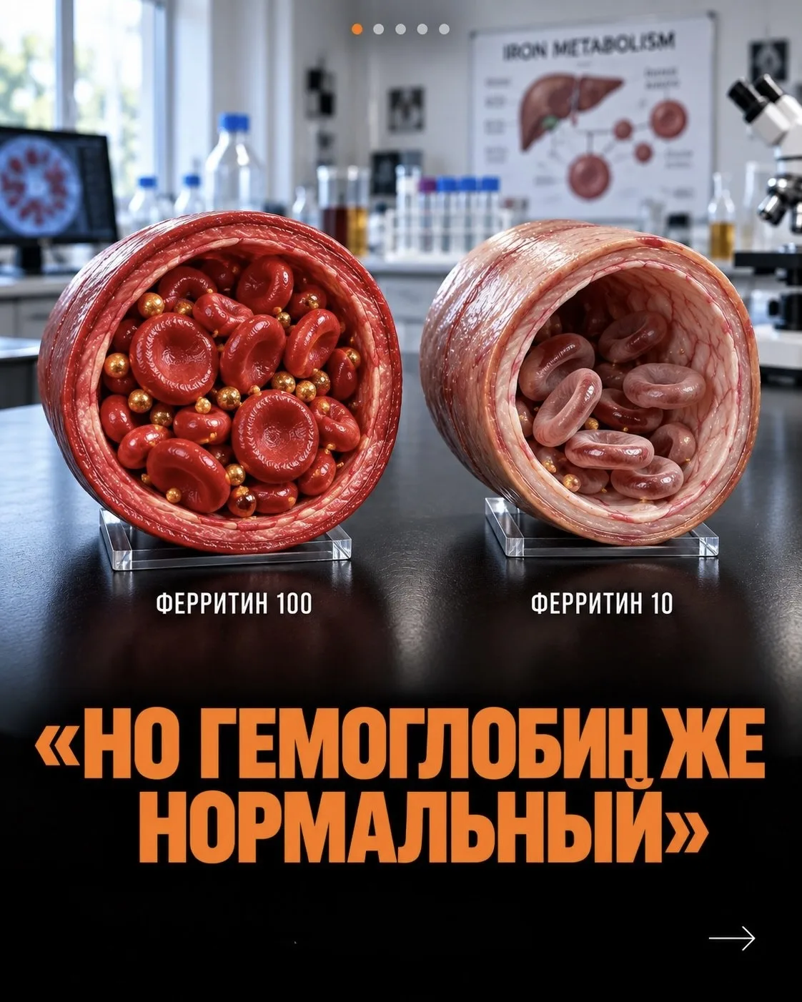 Ферритин 100 vs Ферритин 10