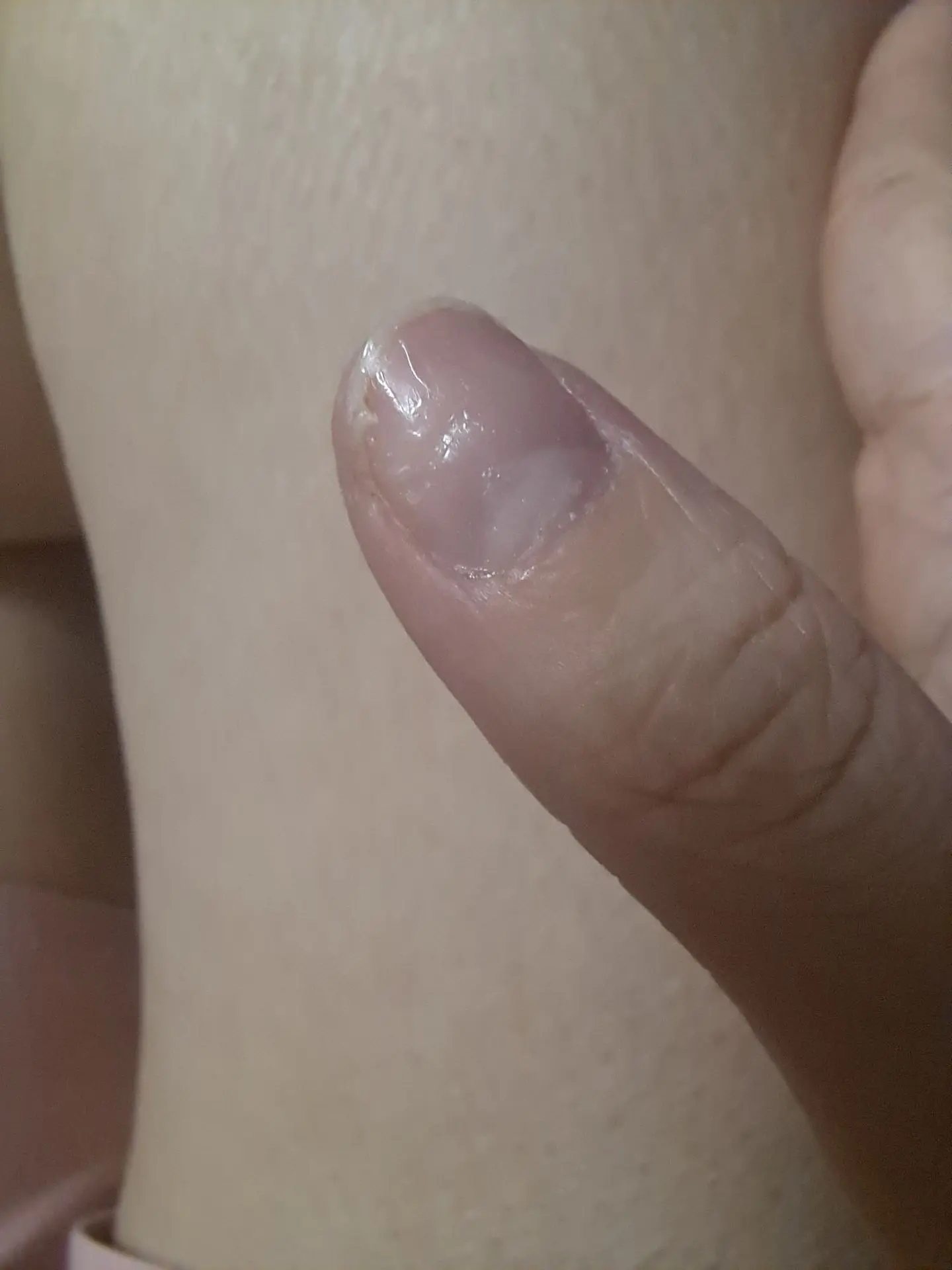 Ноготь и рука. Как сейчас всё на самом деле🫣🥴