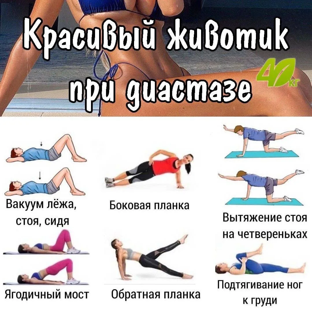 Красивый животик при диастазе!😱