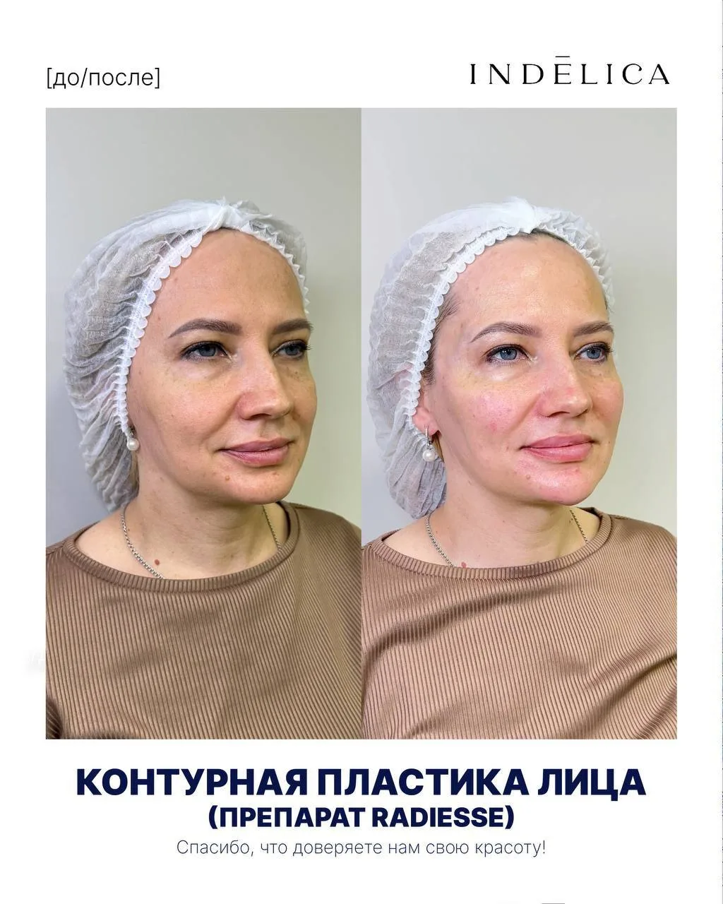 Свежий вид, чёткий овал и гармоничные пропорции — без операции 😍
