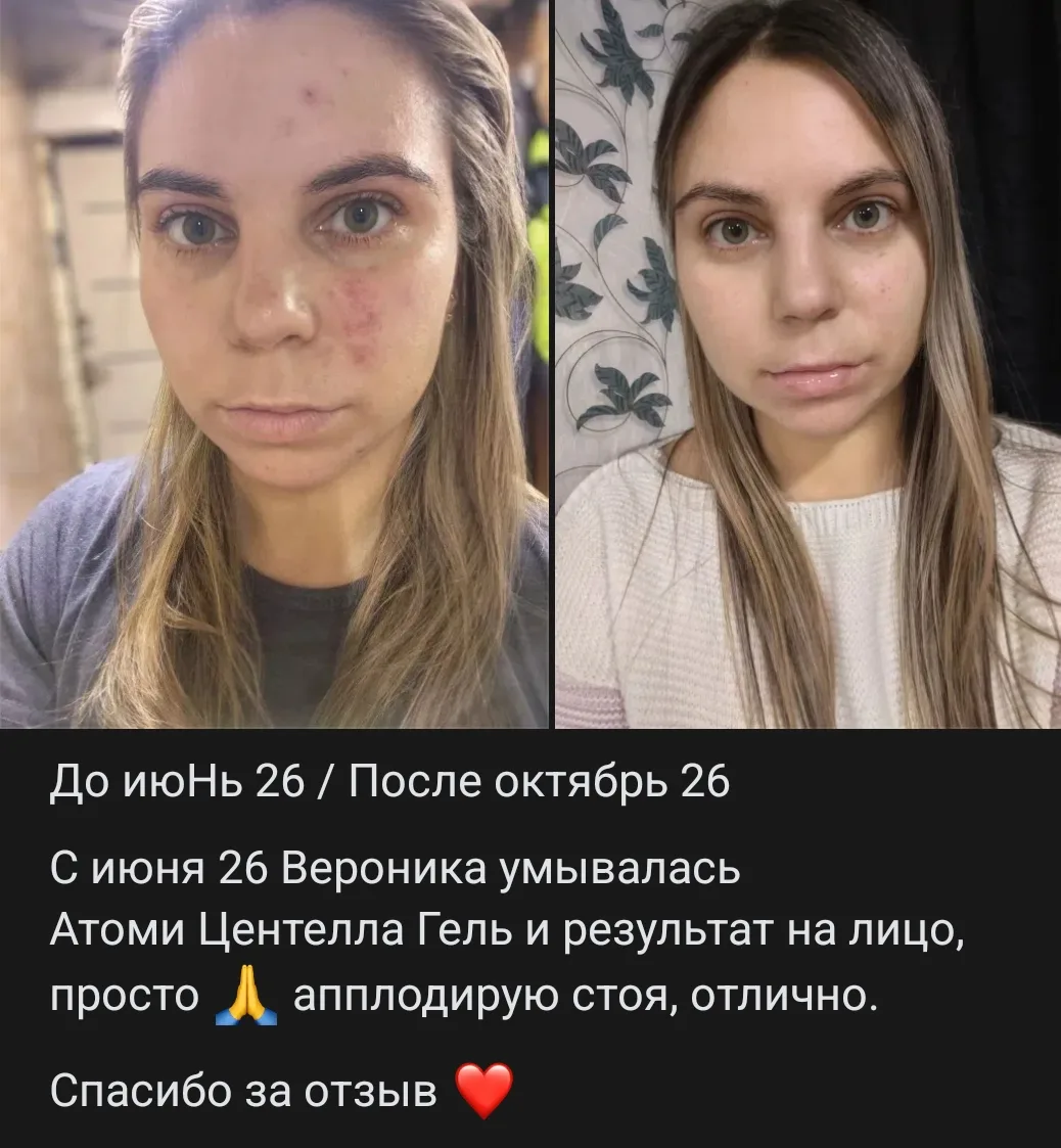 И это только один гель для умывания так сработал!!!🔥🔥🔥