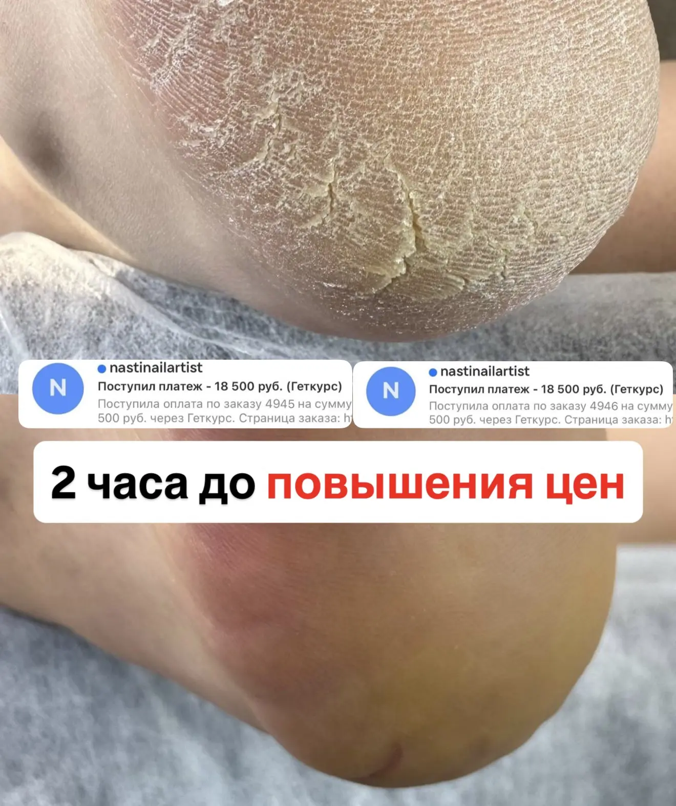 Осталось всего 2 часа до ПОДНЯТИЯ ЦЕН