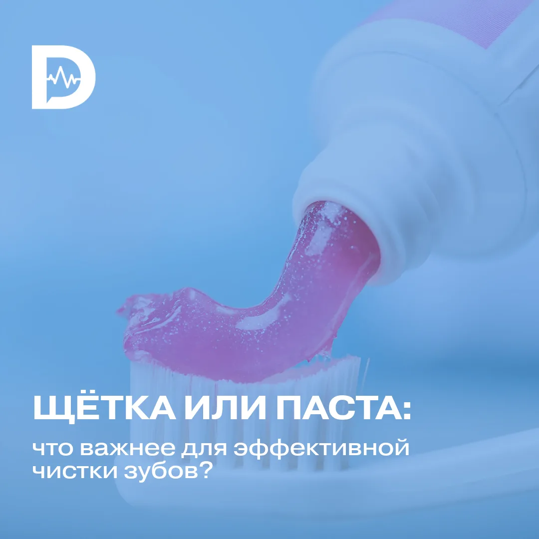 Что важнее для удаления налёта — щётка или паста? Можно ли хорошей пастой компенсироват...