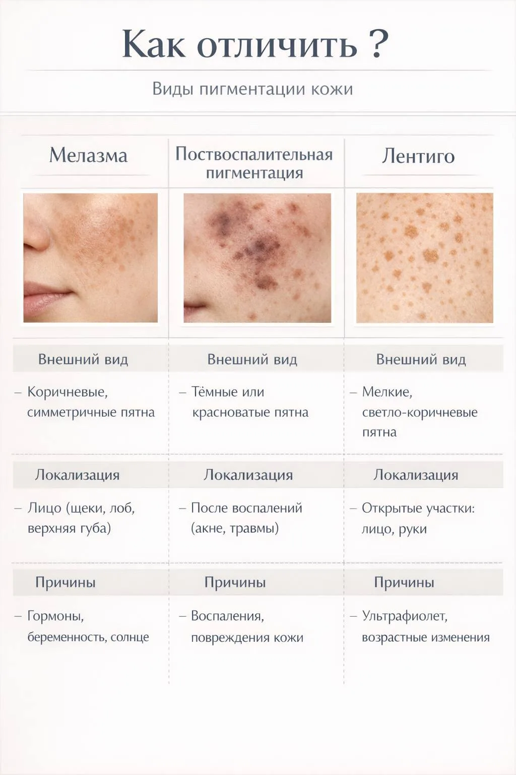 Мелазма, поствоспалительная пигментация и лентиго