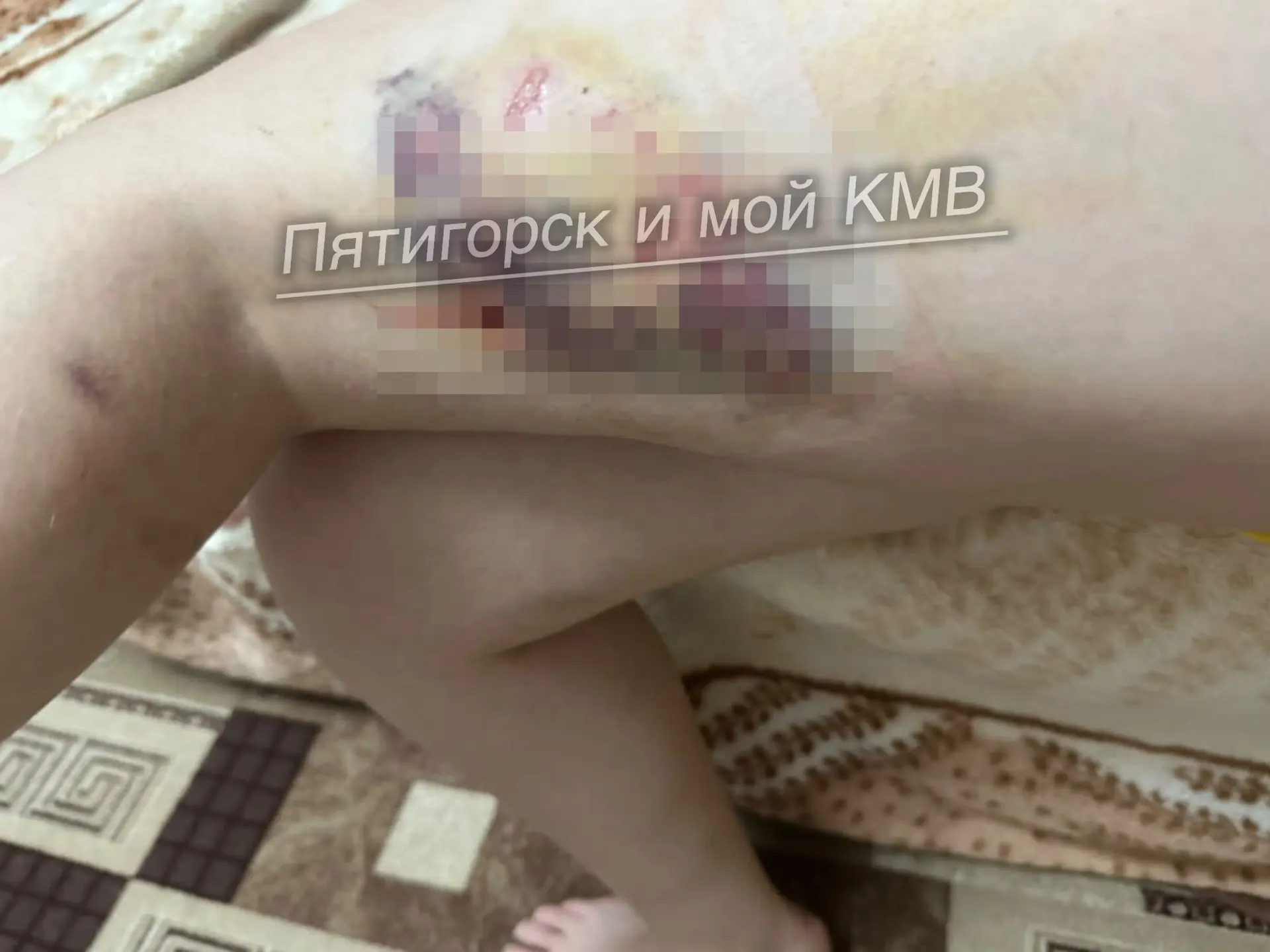 Хочу предать огласке ужасную ситуацию, которая происходит у нас в городе на Московской,...