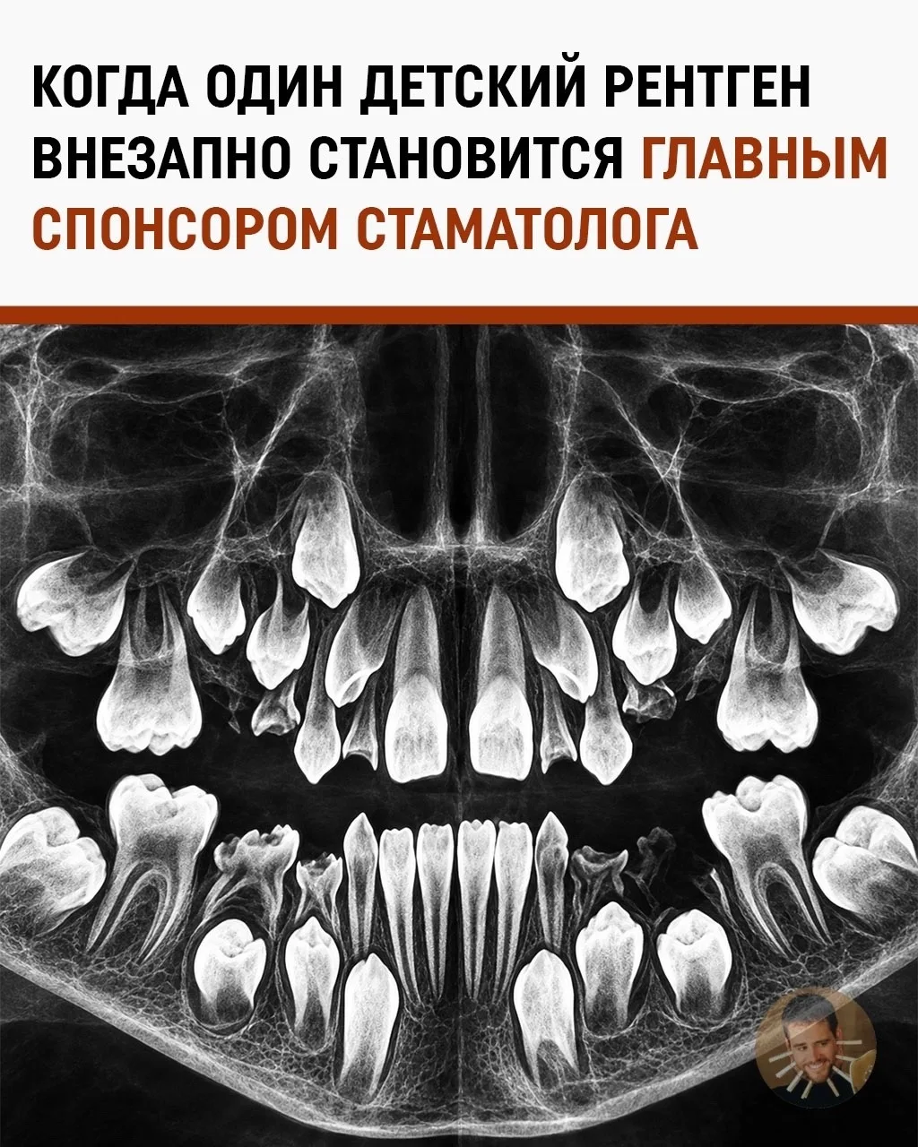 Рентген восьмилетнего мальчика заставил стоматологов открыть автосалоны