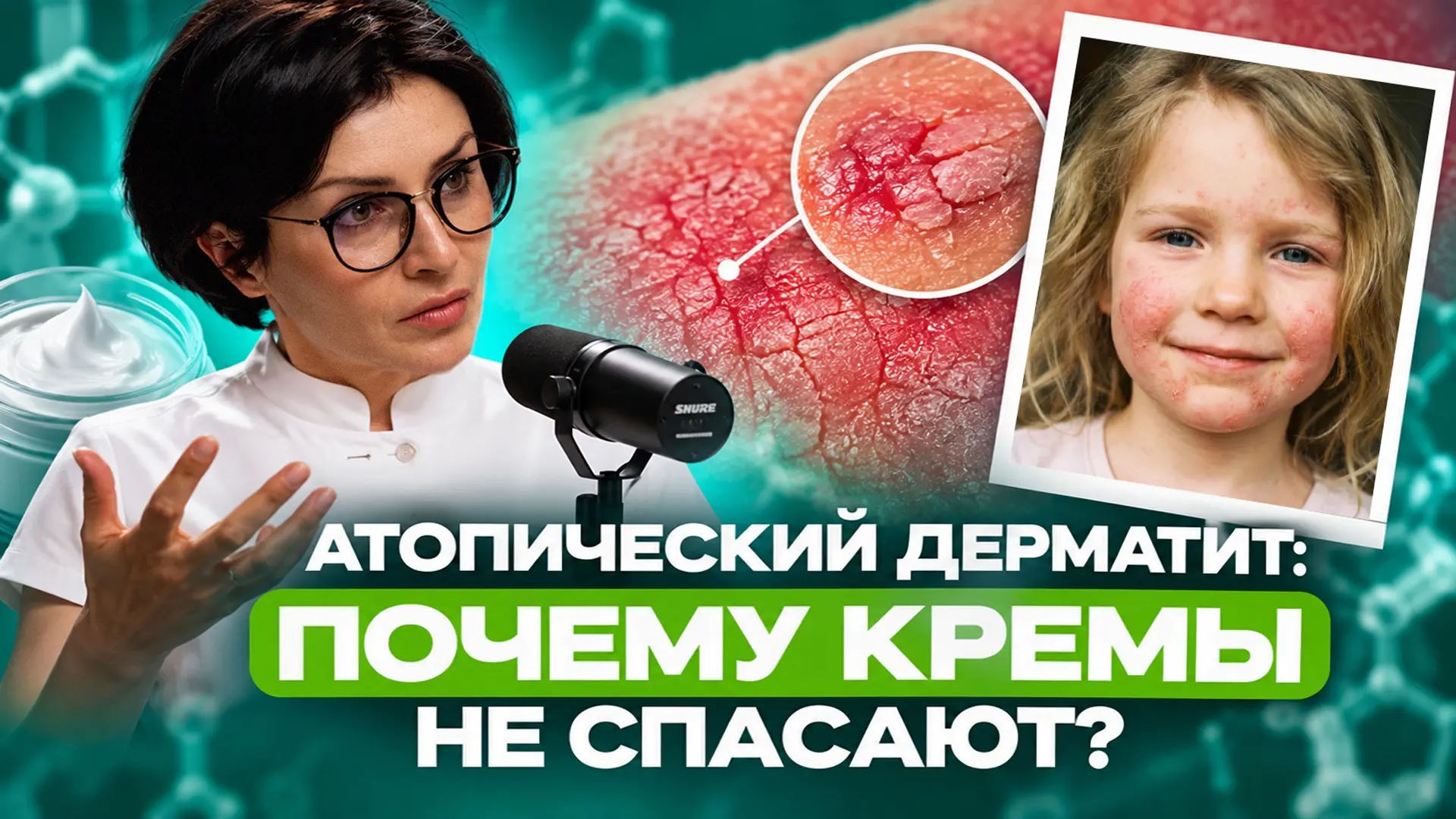 Почему атопический дерматит возвращается с наступлением холодов? 🌿