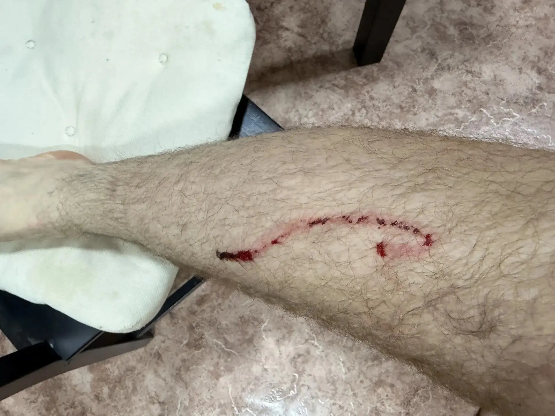 Нам пишут: по всему проспекту Химиков подобные «ловушки». Не видно даже человеку с хоро...