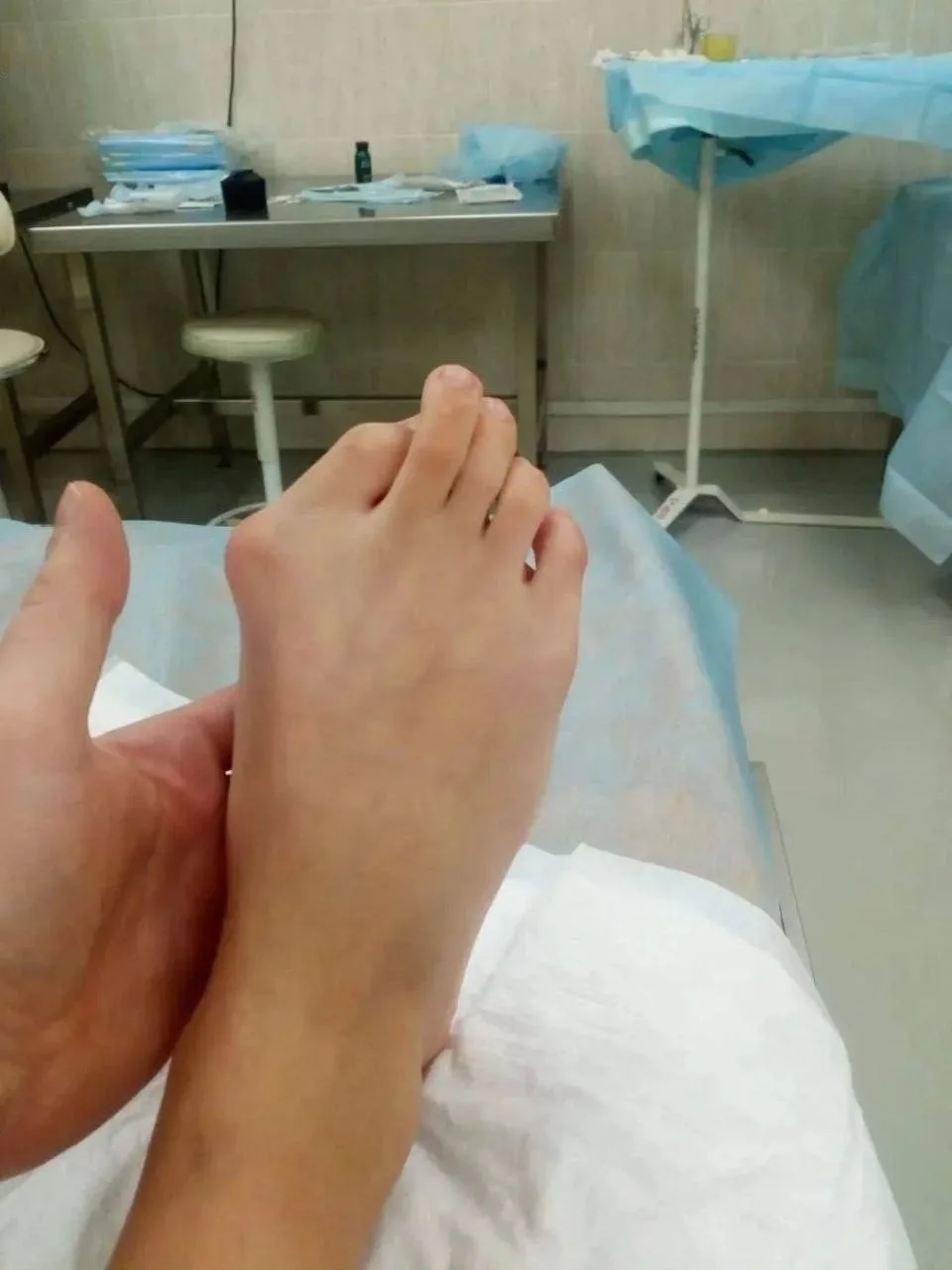 🦶🏥 В Приморье подросткам бесплатно исправляют «крестьянскую стопу» — операция занимае...