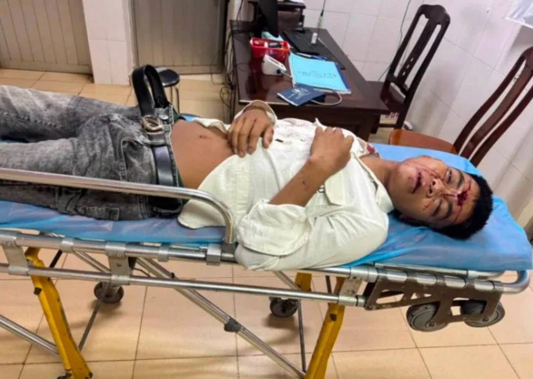 Вьетнамец психанул после ссоры с девушкой и эффектно уехал прямо под автобус.