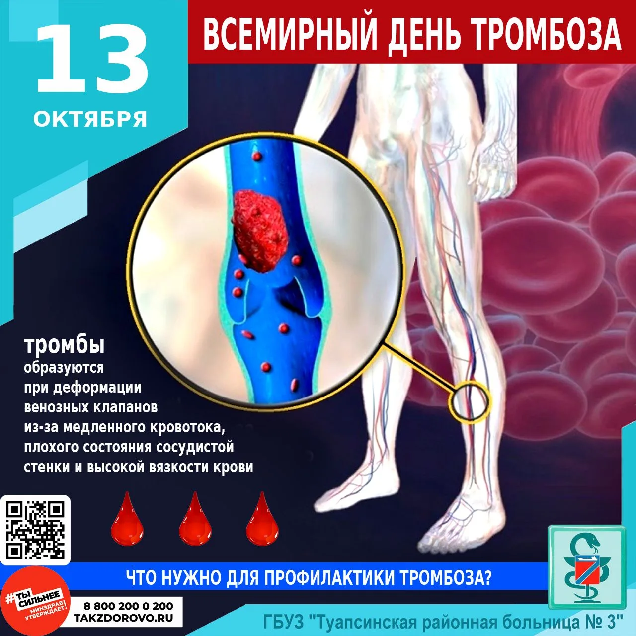 КАК ПРЕДОТВРАТИТЬ РАЗВИТИЕ ТРОМБОЗА