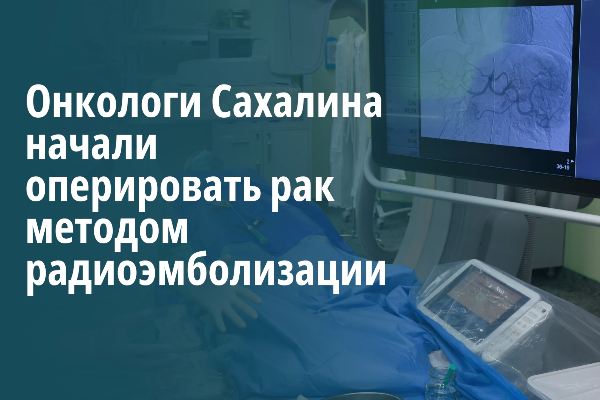 Онкологи Сахалина начали оперировать рак методом радиоэмболизации