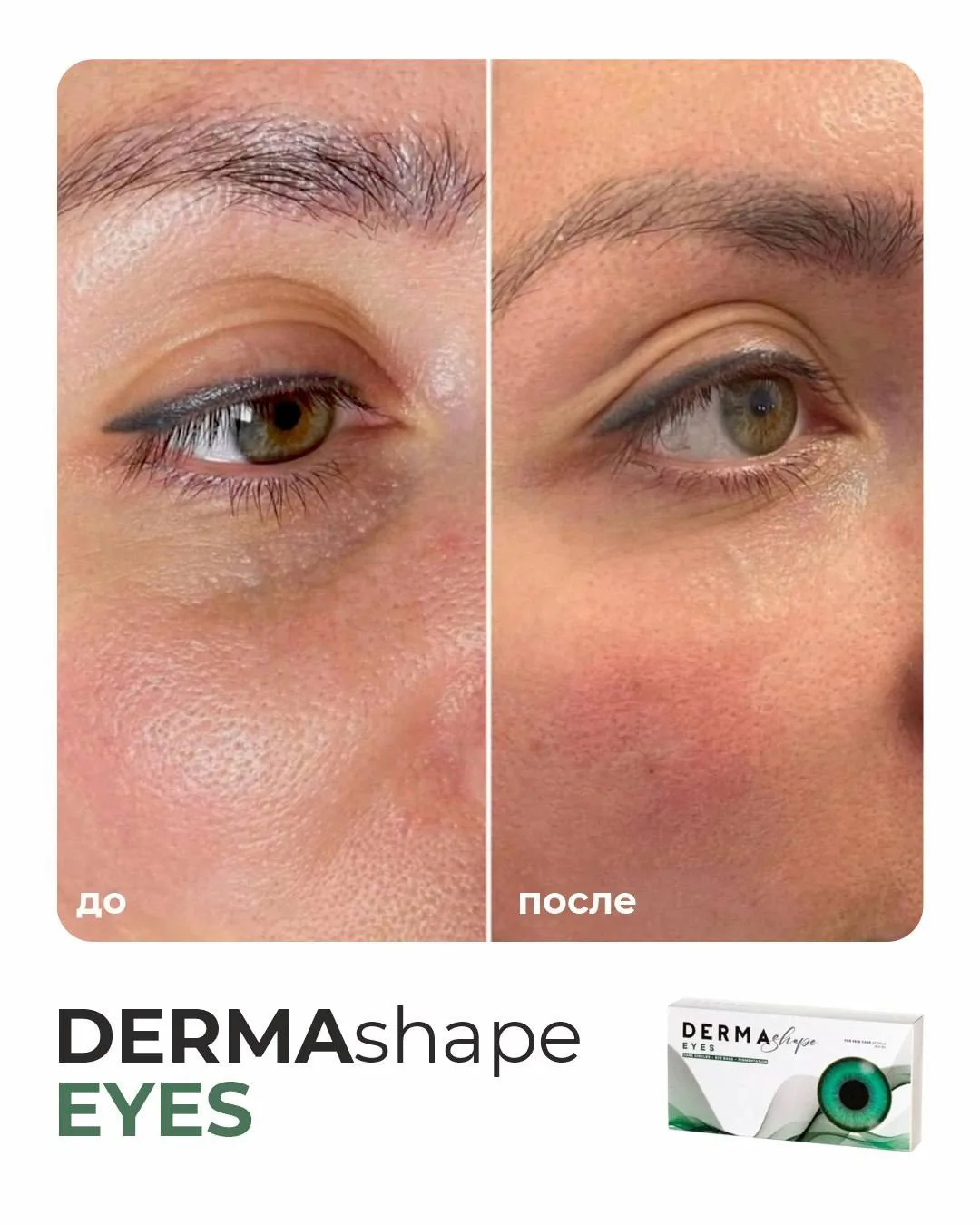 До / После ✨ DERMA SHAPE EYES - деликатная забота о самой требовательной зоне лица.