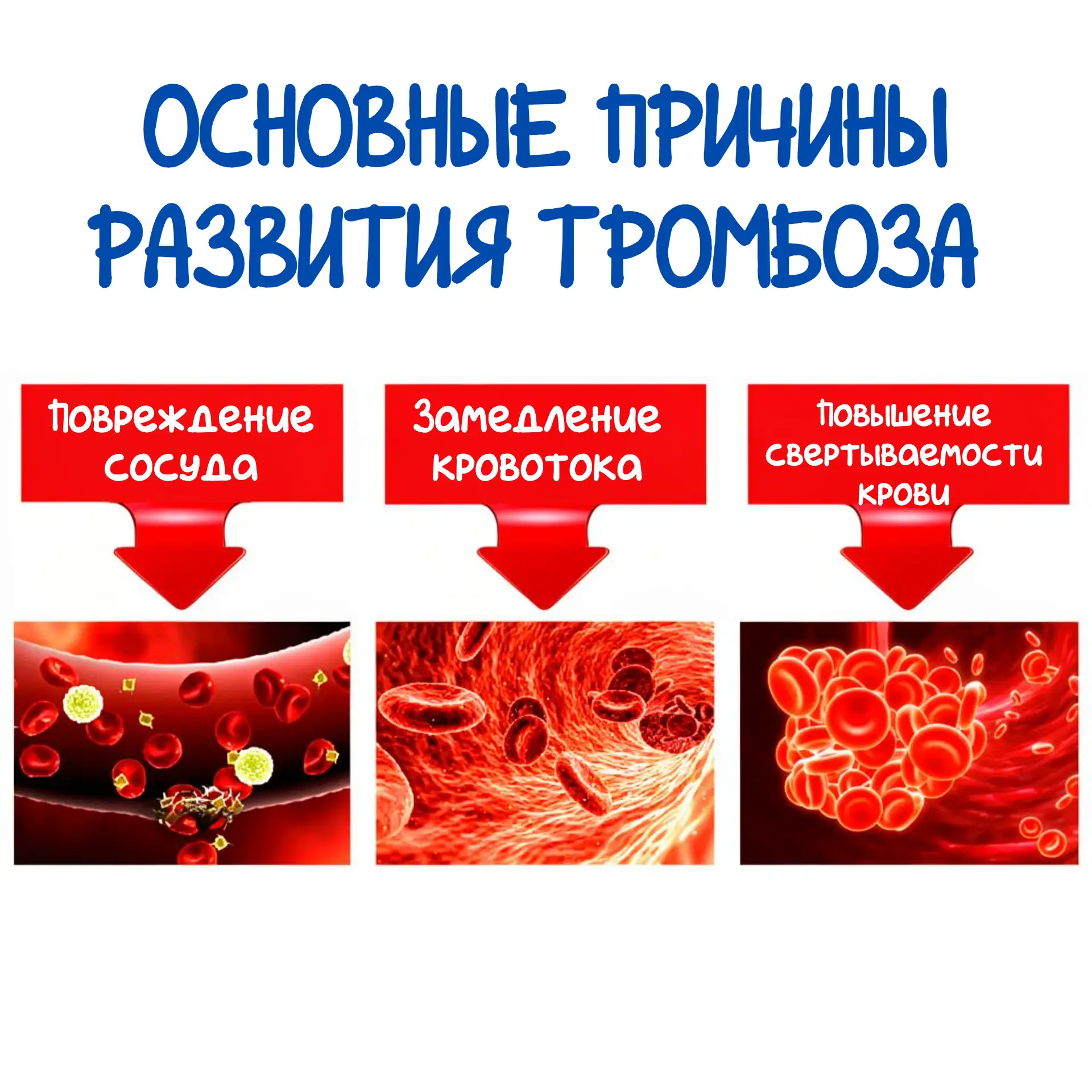 🩸 13 октября — Всемирный день тромбоза