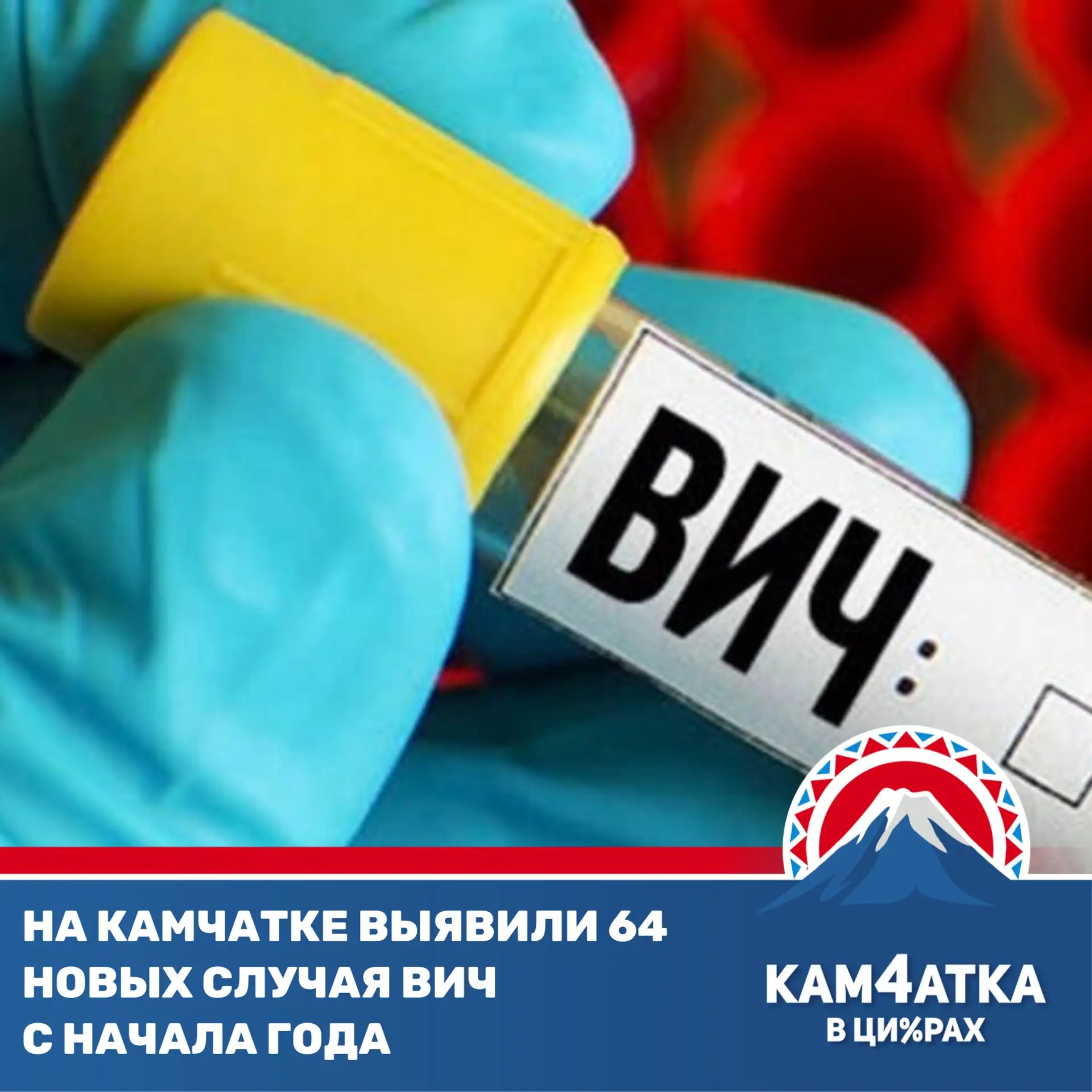 Кто чаще заражается ВИЧ на Камчатке?
