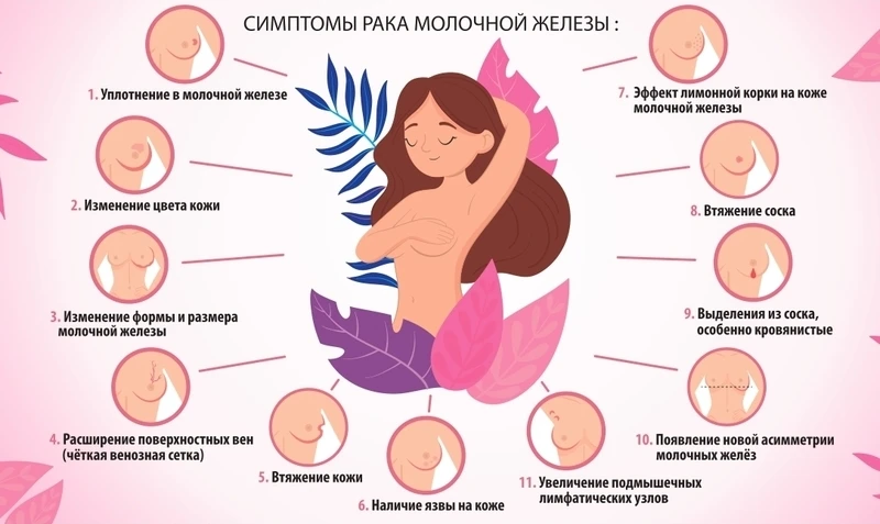 Сигналы тревоги рака молочной железы