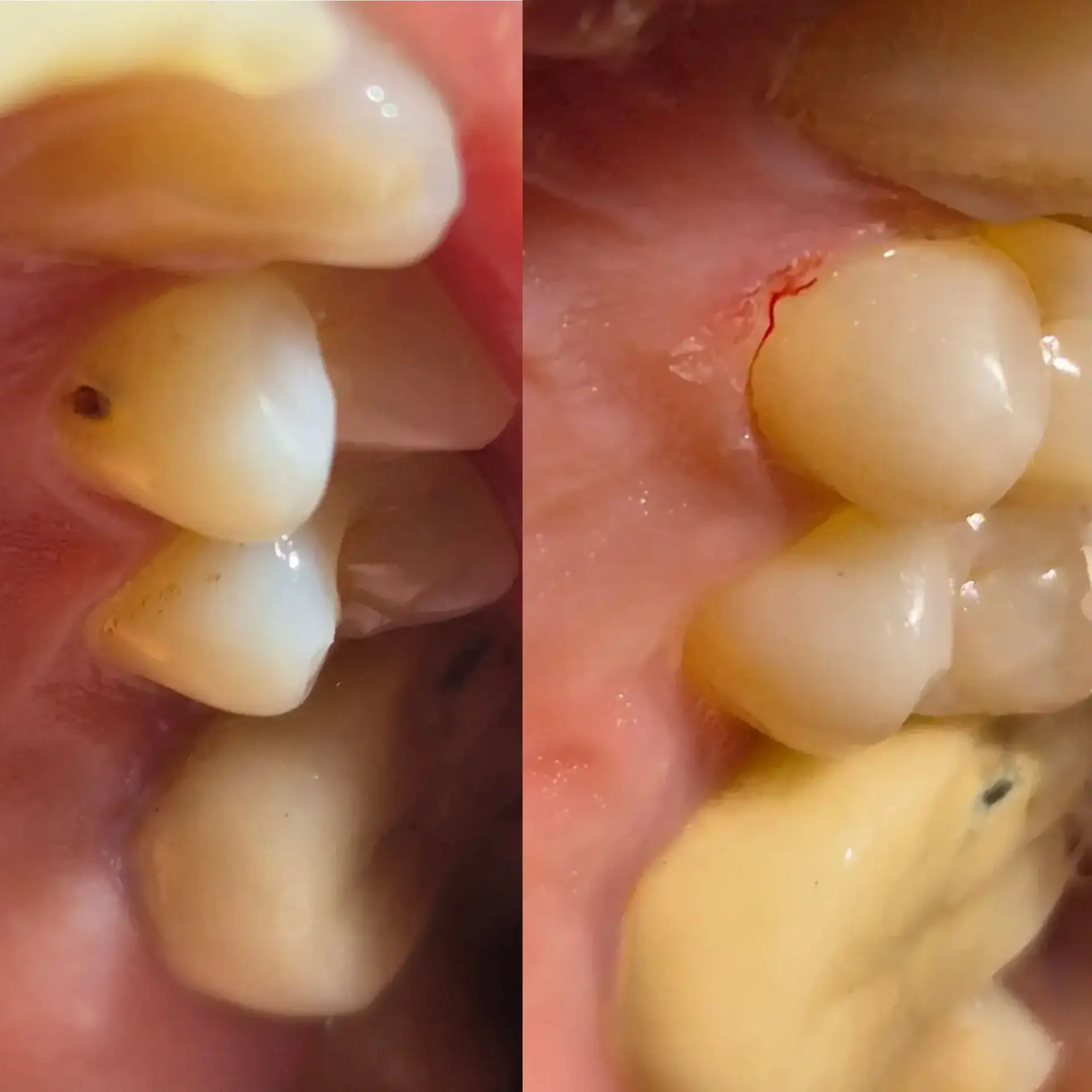 Клинический случай 🦷