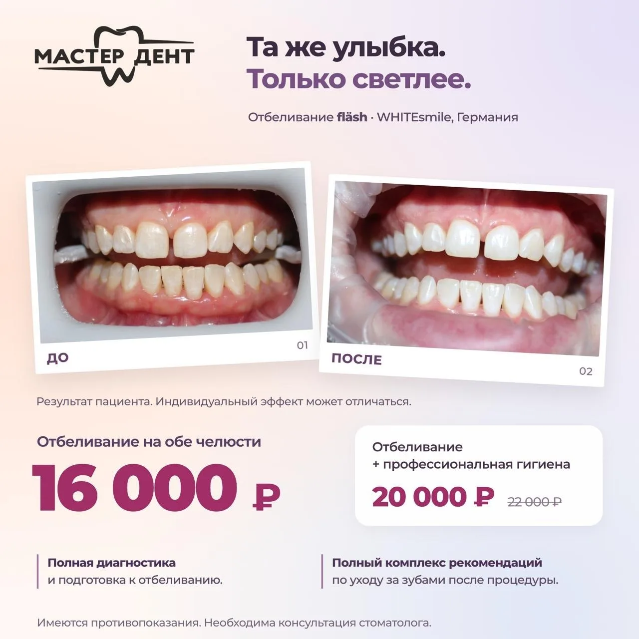 Белоснежная улыбка начинается не с отбеливания.