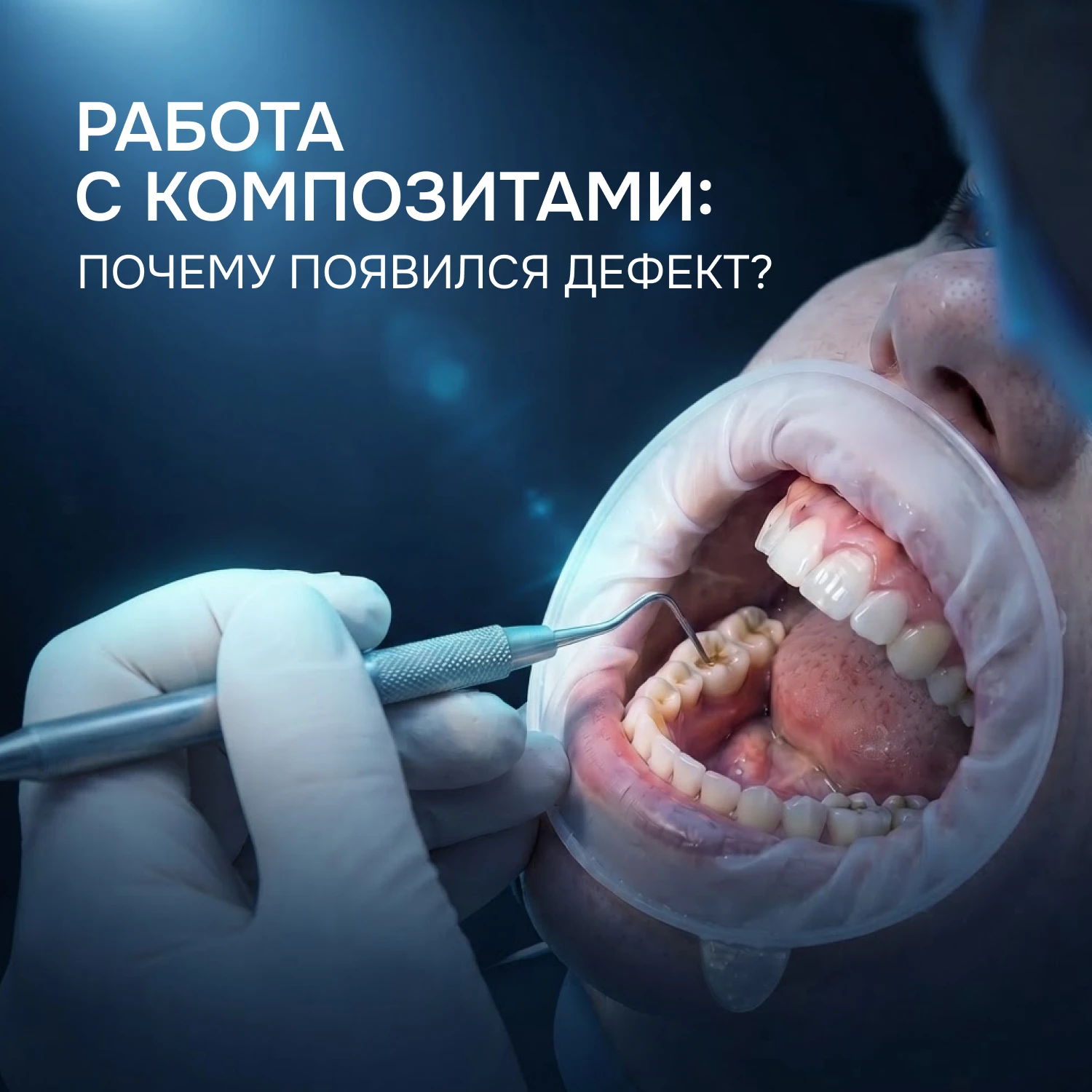 Почему через короткое время реставрация перестала быть идеальной?
