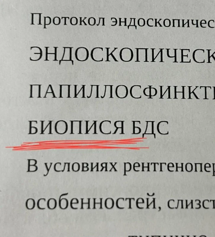 😳