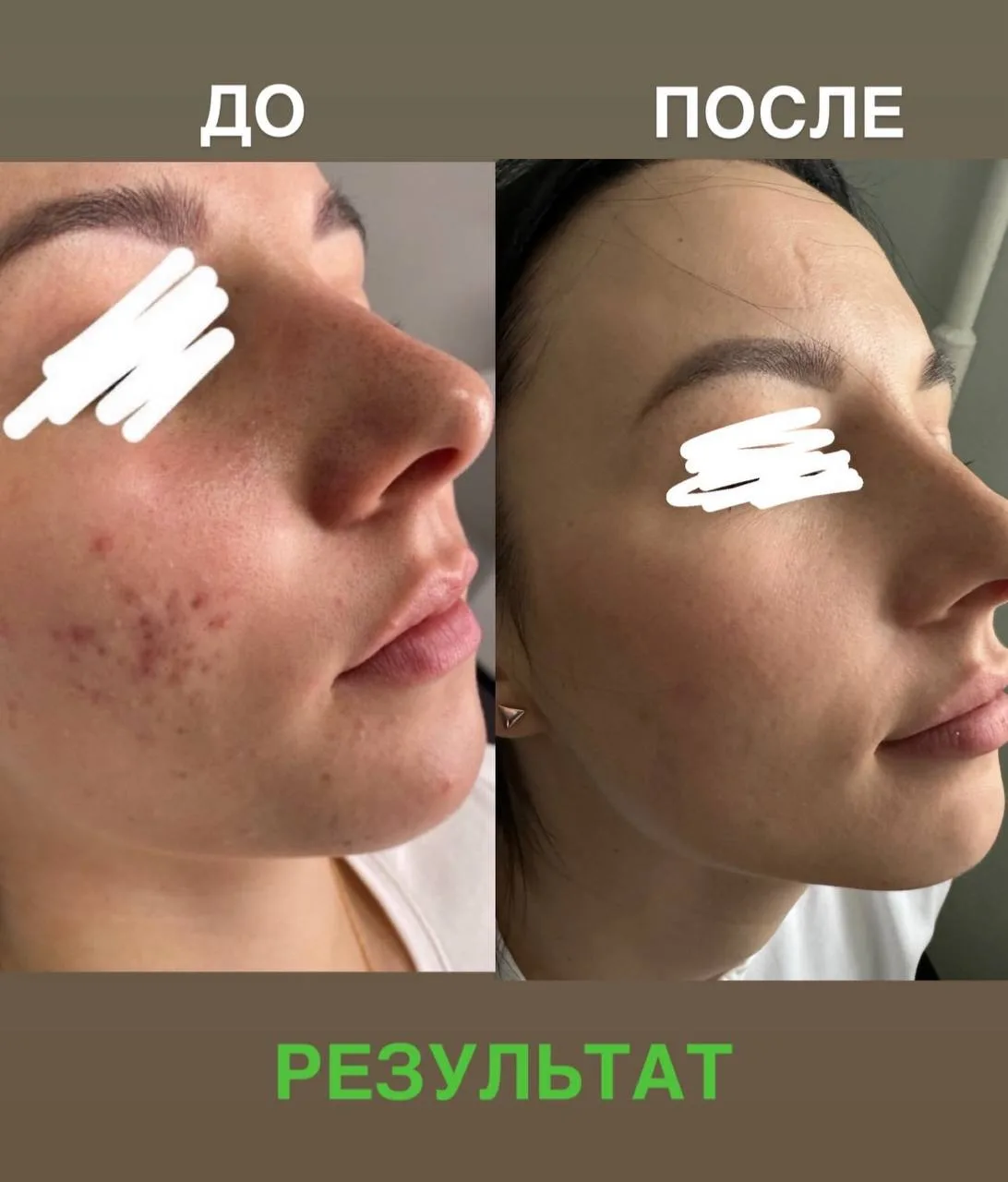 ✨ Видимый результат — это всегда комплексная работа! ✨