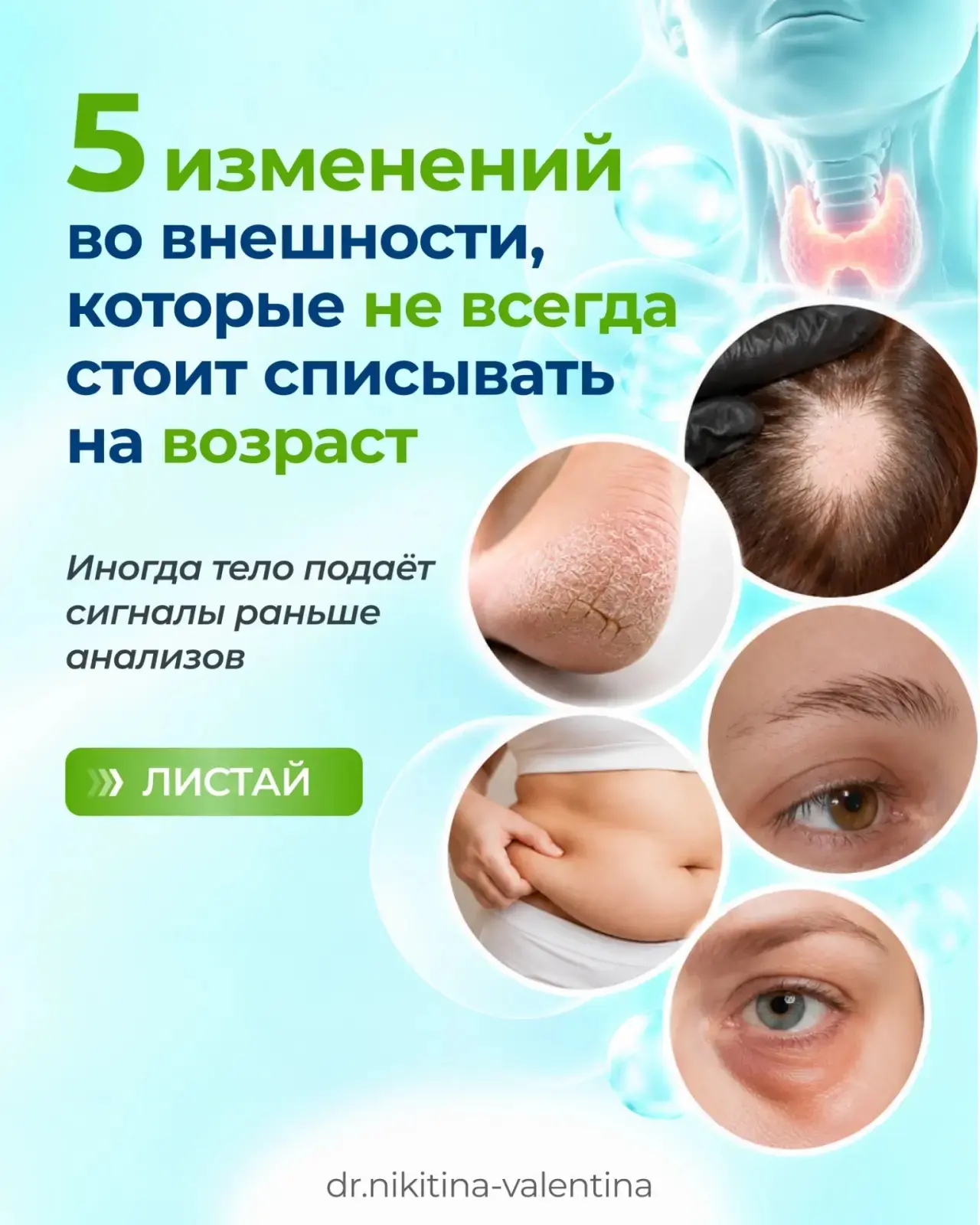 Иногда внешность меняется раньше, чем человек понимает, что в организме что-то пошло не...