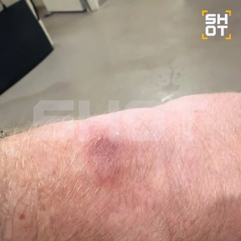 Владельцы новых Apple Watch Series 12 и Ultra 4 жалуются на раздражение кожи. После исп...