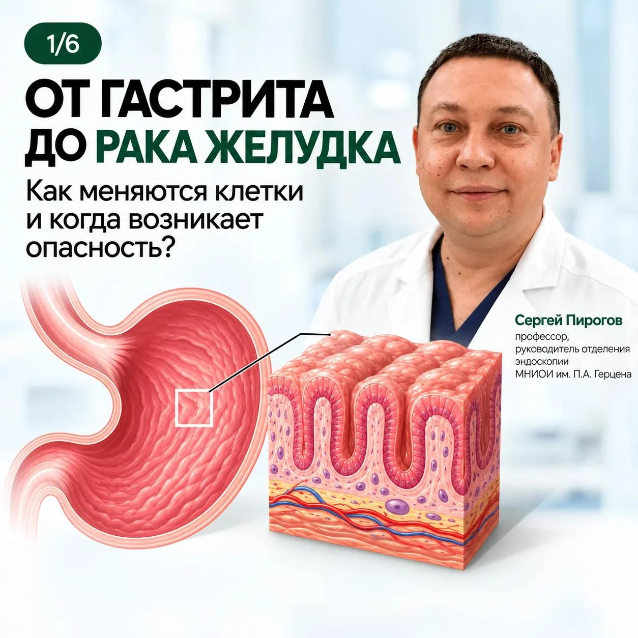 ОТ ГАСТРИТА ДО РАКА ЖЕЛУДКА: ЧТО ПРОИСХОДИТ СО СЛИЗИСТОЙ?