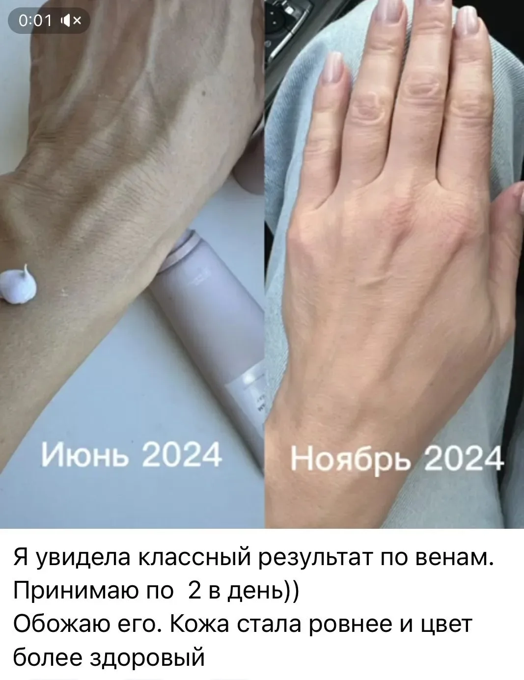 даже ручки ваши омолодятся и венки станут незаметными 🙌😍