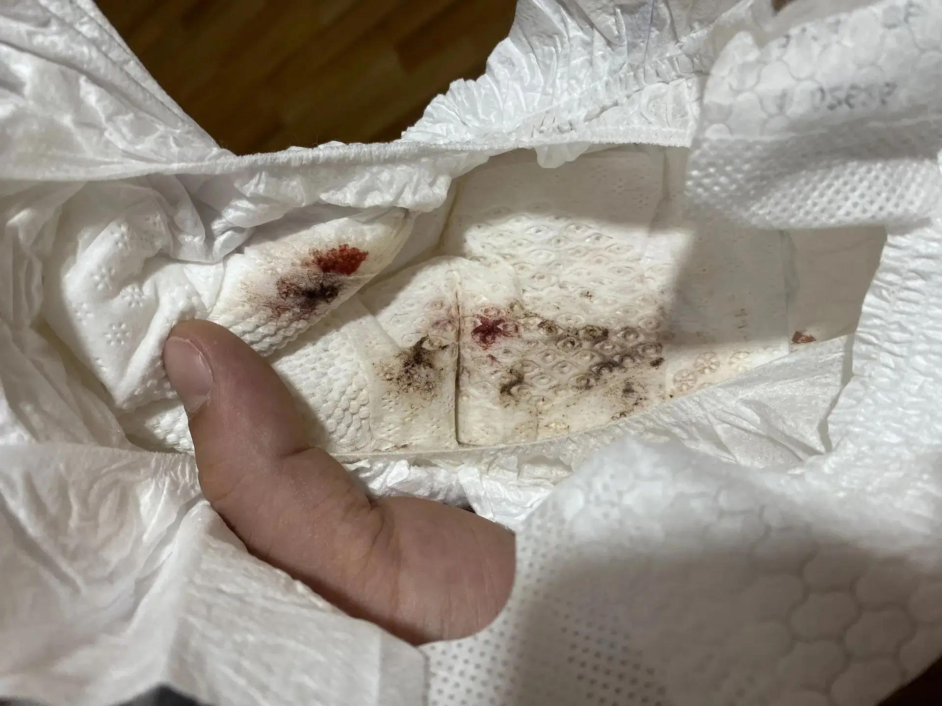 🙀Малышка сходила в туалет, а на пеленке ПЯТНО КИРПИЧНОГО ЦВЕТА! Что это?