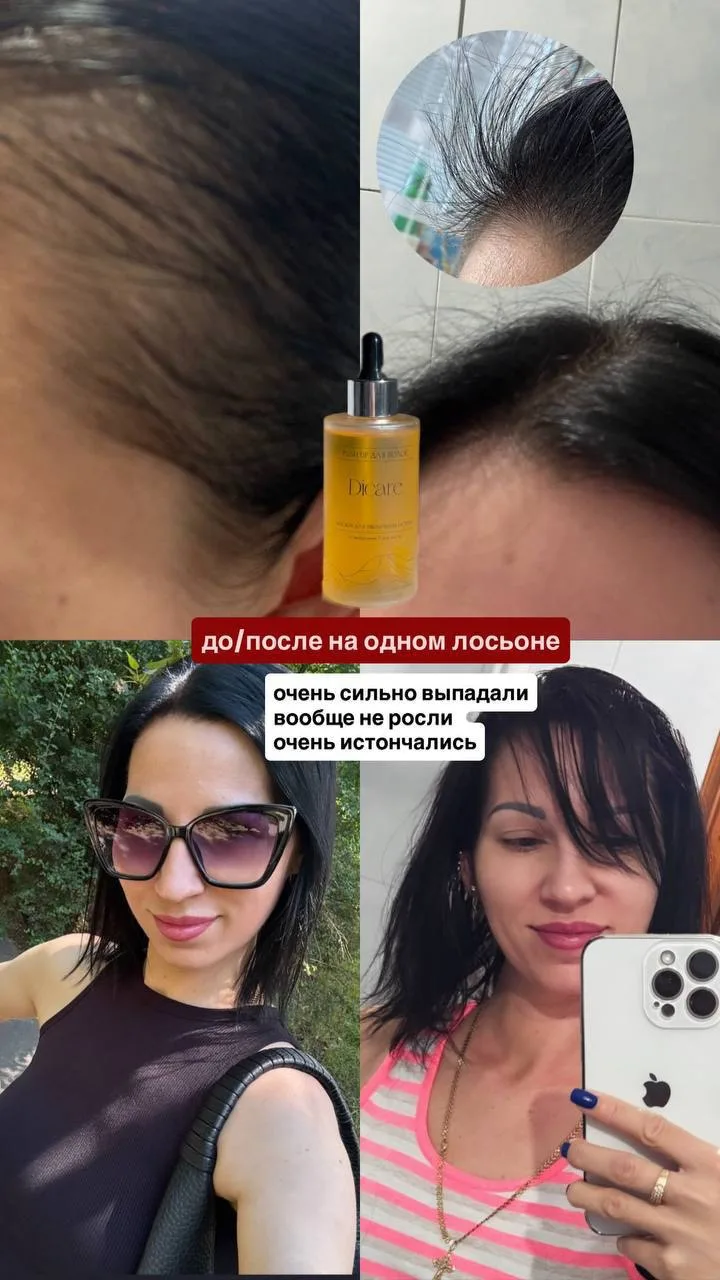 И если подытожить всё вышесказанное, то наш лосьон PUSH UP от DiCare — максимально унив...