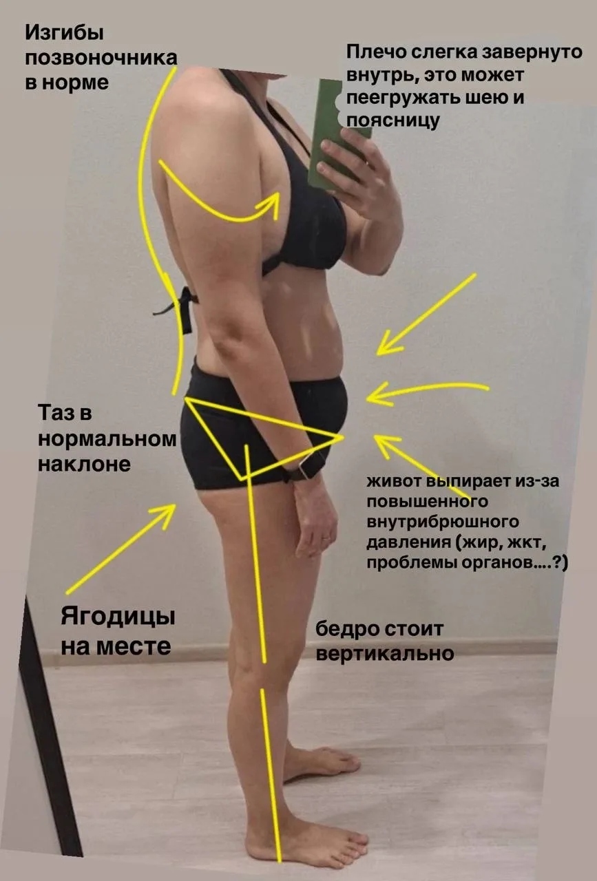 Ситуация: торчит живот при хорошей осанке.
