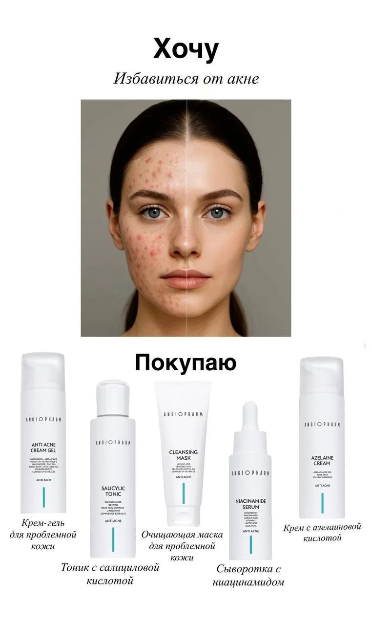 Консультации.