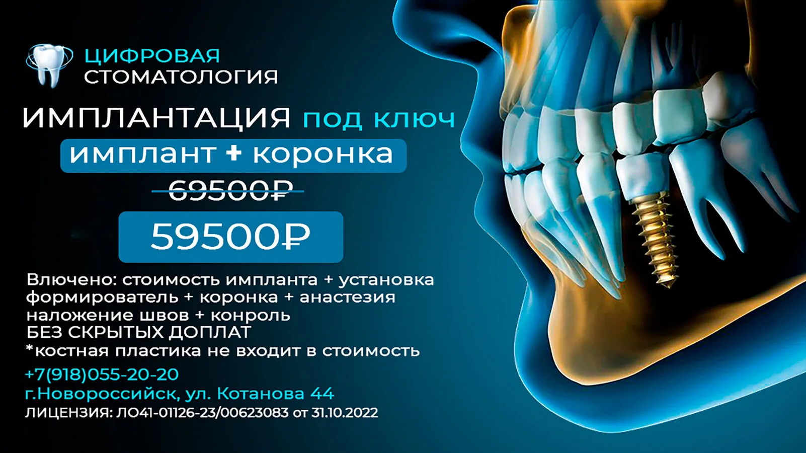 Позаботьтесь о своей улыбке выгодно в Новороссийске